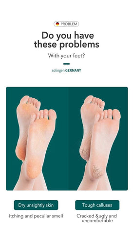 Image of MR.GREEN Pedicure Foot Care Tool soloution  foot problems